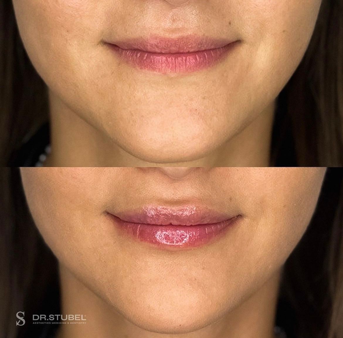 Marco Rizzetto Stubel-4