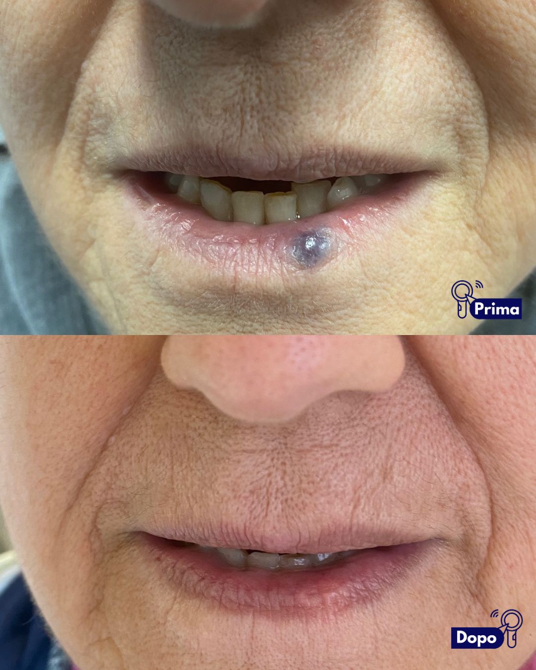 Alfredo Piccerillo-3