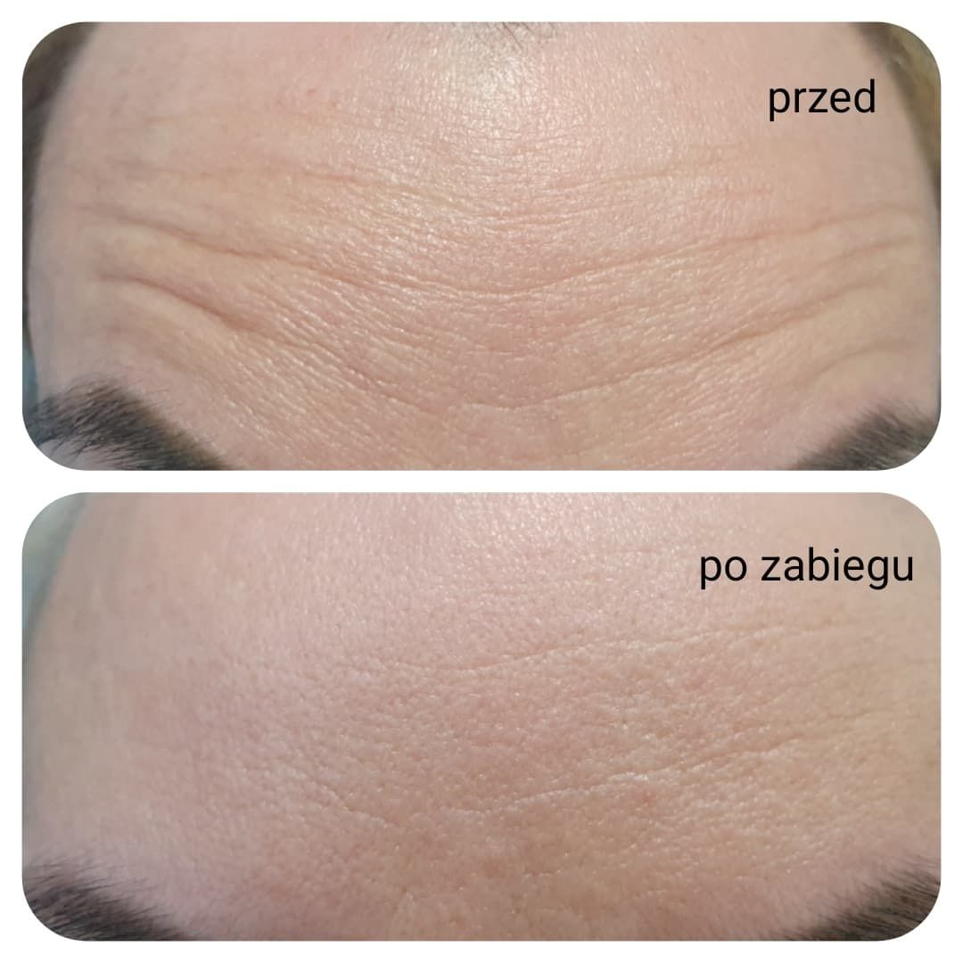 Agnieszka Cegielska-4