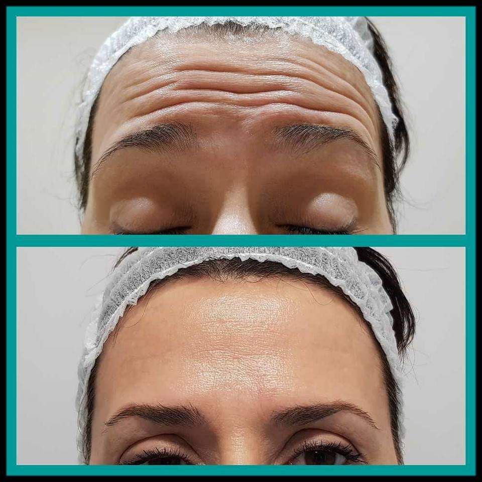 Rosalba Herrero Zerpa-393