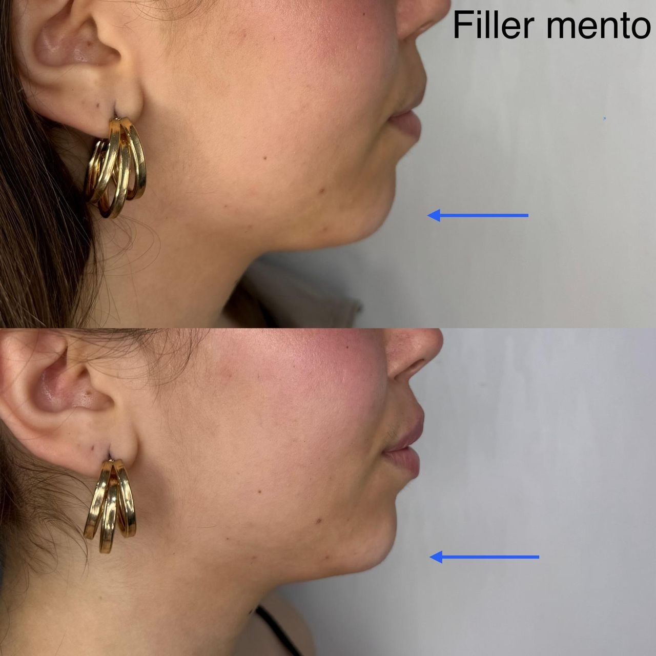 Raffaela Esposito-19