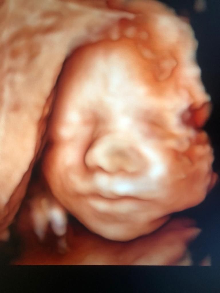 Dilek Turğut Kestane-11