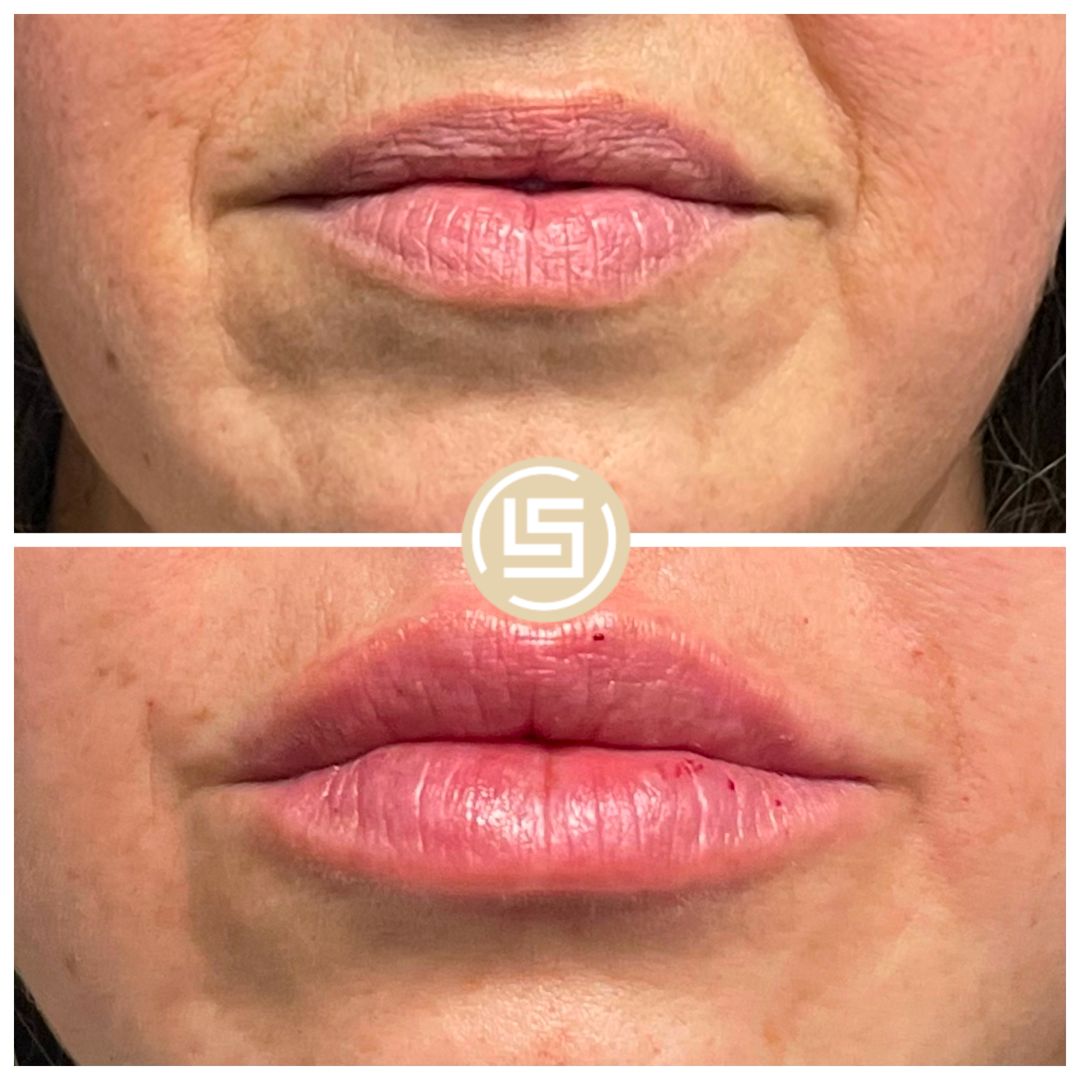 Camilo López Socarrás-28