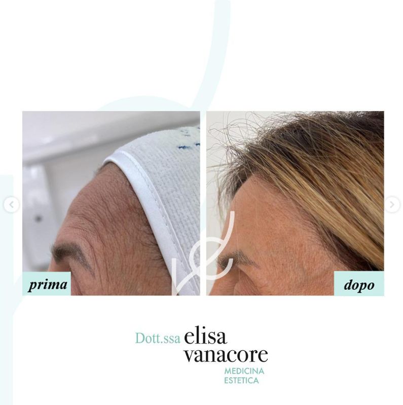 Elisa Vanacore-17