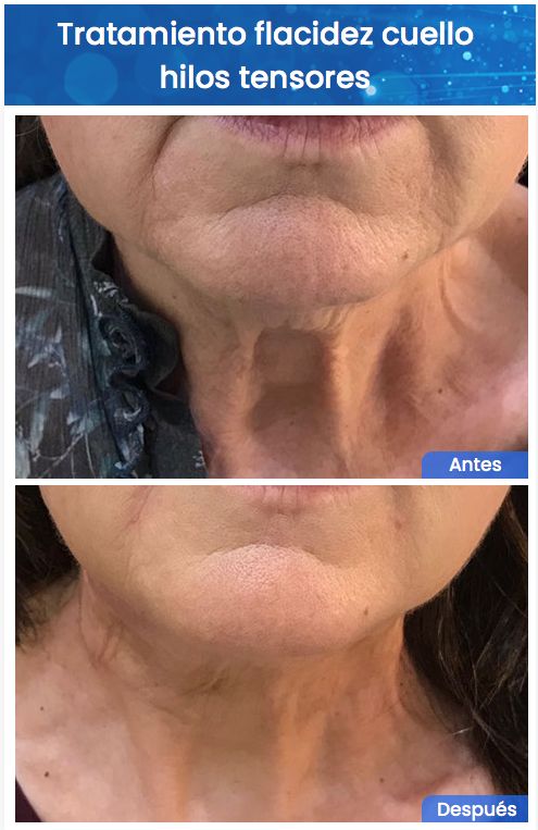 Juan Enrique Pérez Enríquez-135