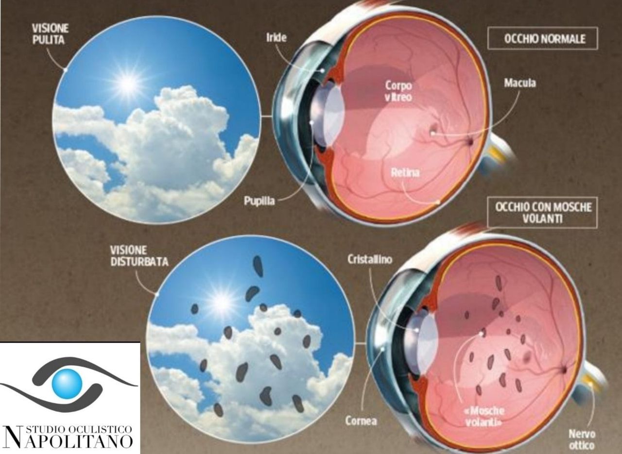 Pasquale Napolitano-17