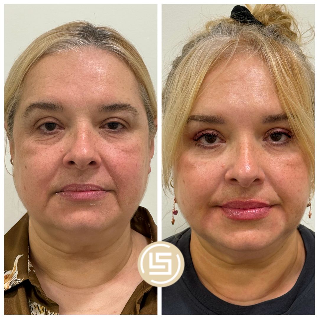 Camilo López Socarrás-22