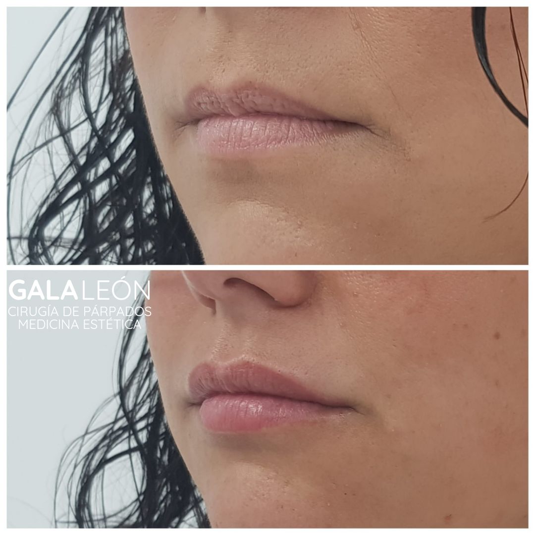 Gala P. Leon Salvatierra-25