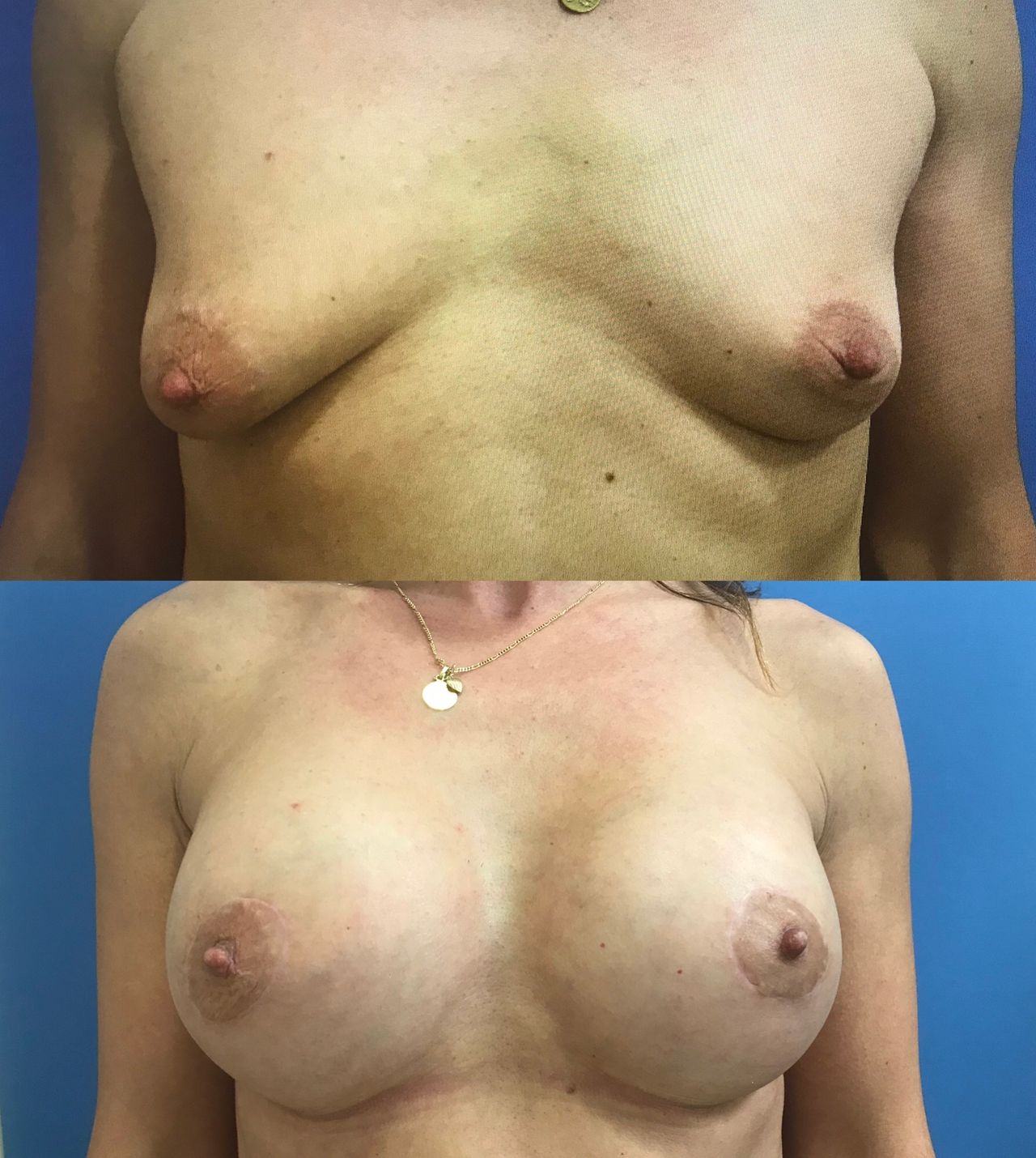 Esther Espinel Pérez-4