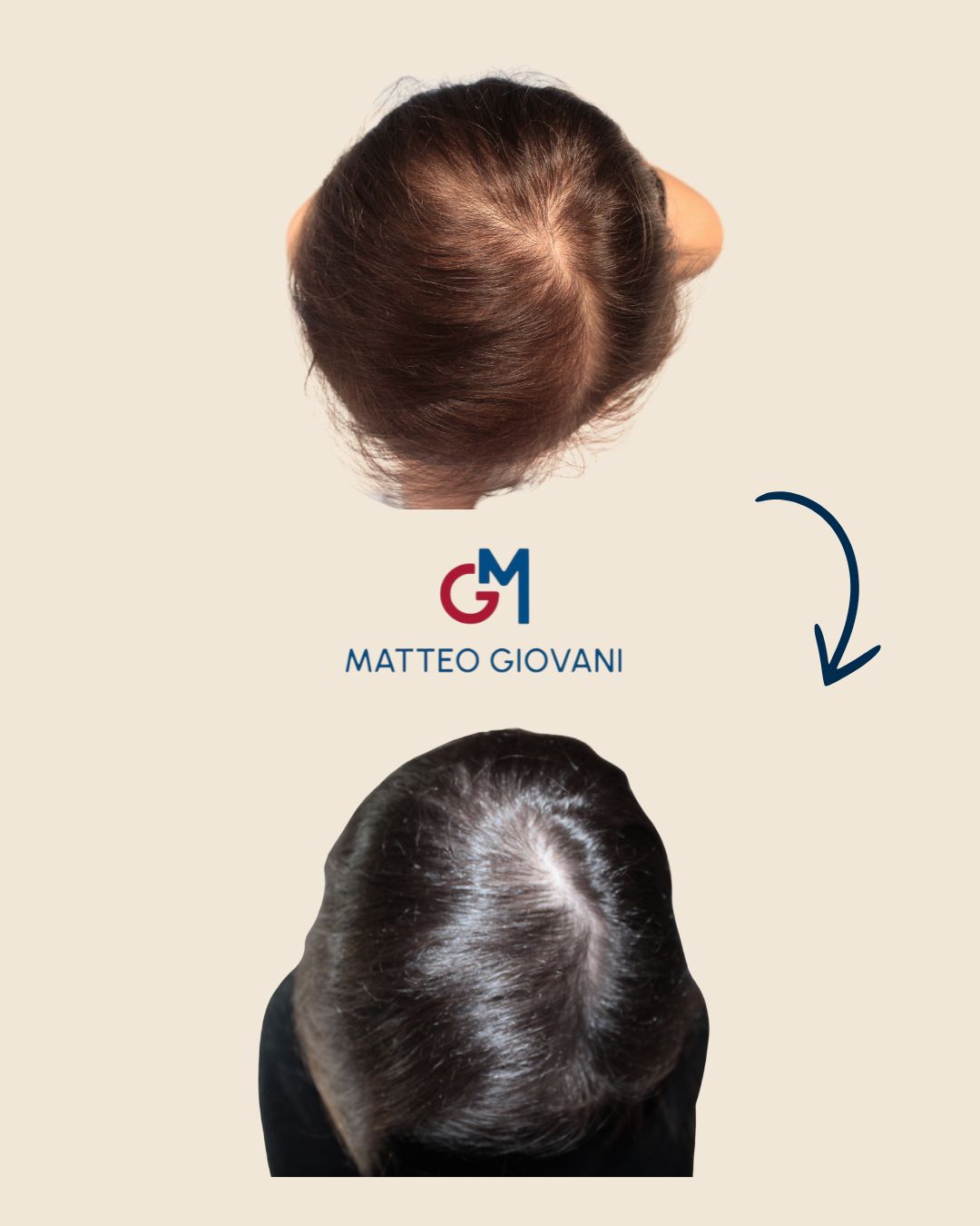 Matteo Giovani-15