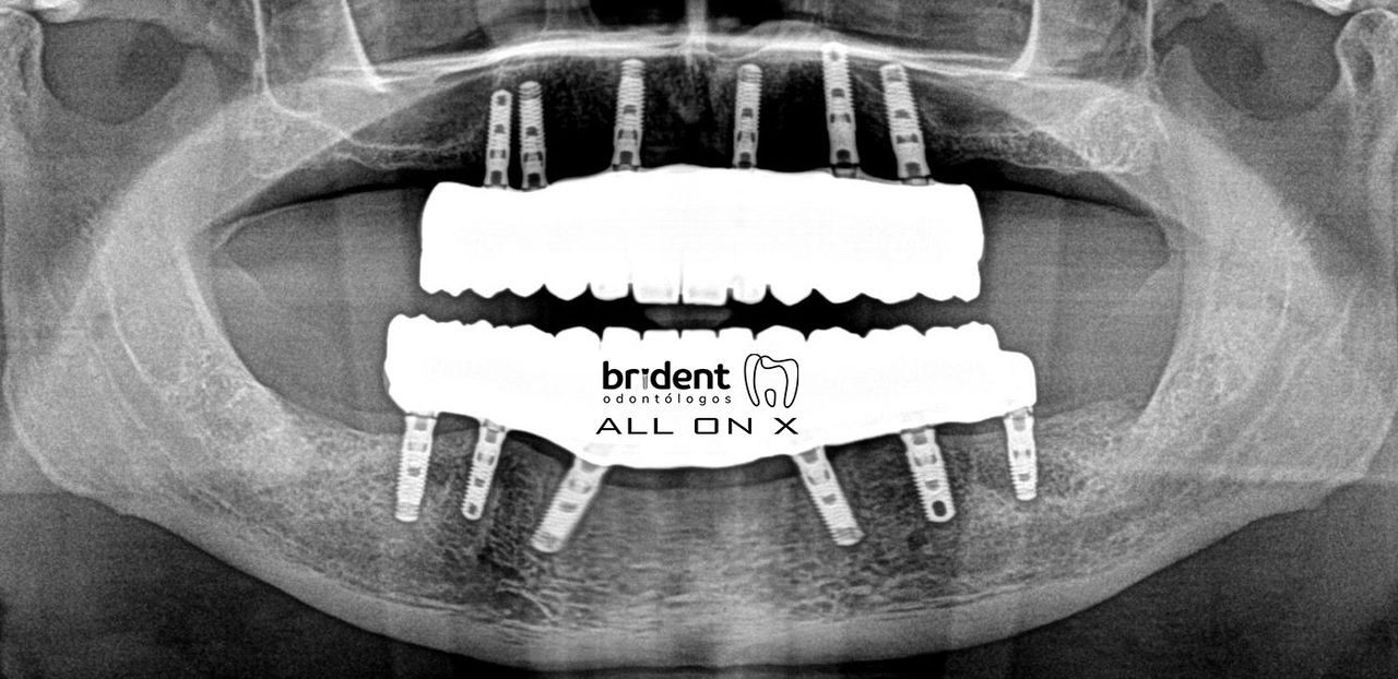 Guillermo Moreno Masiá-47