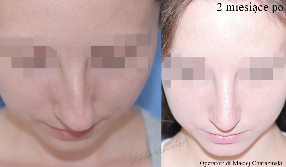 Maciej Charaziński-4