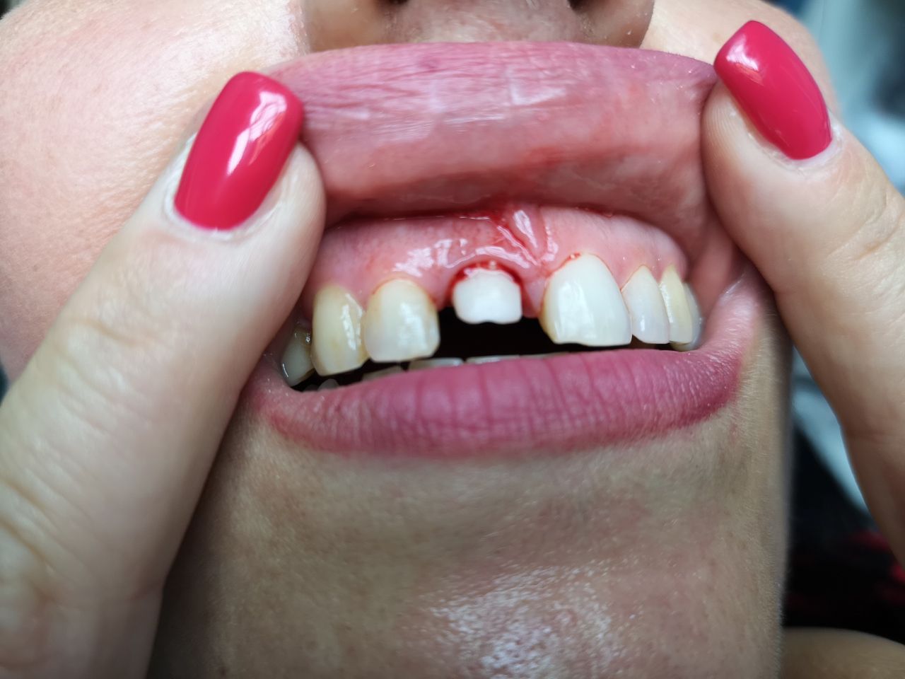 Stefano De Simone-53