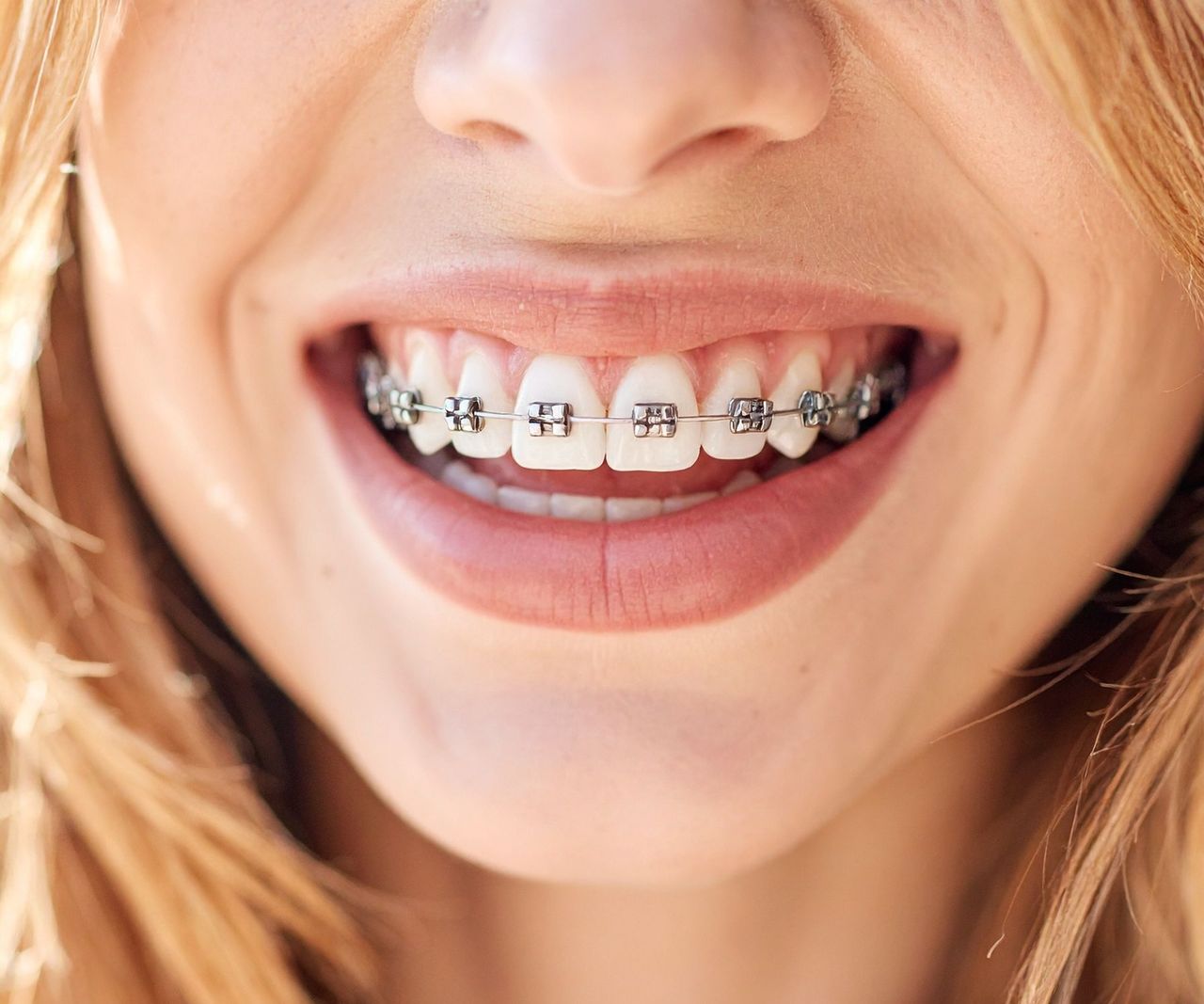 Francesco Carpenteri-10