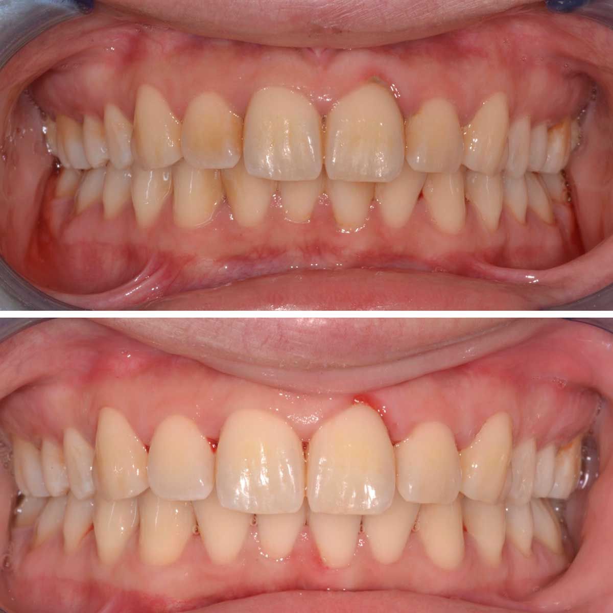 Gianluigi Bittante-84