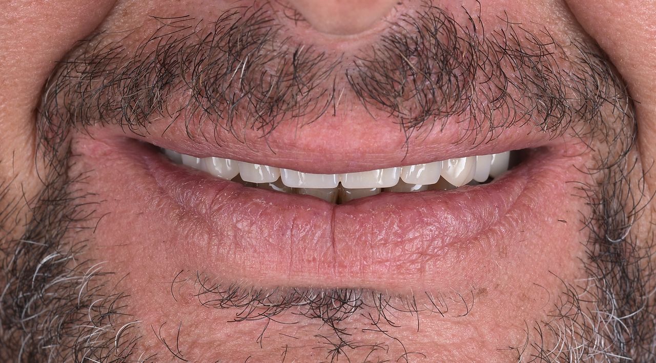 Riccardo Giardina-56