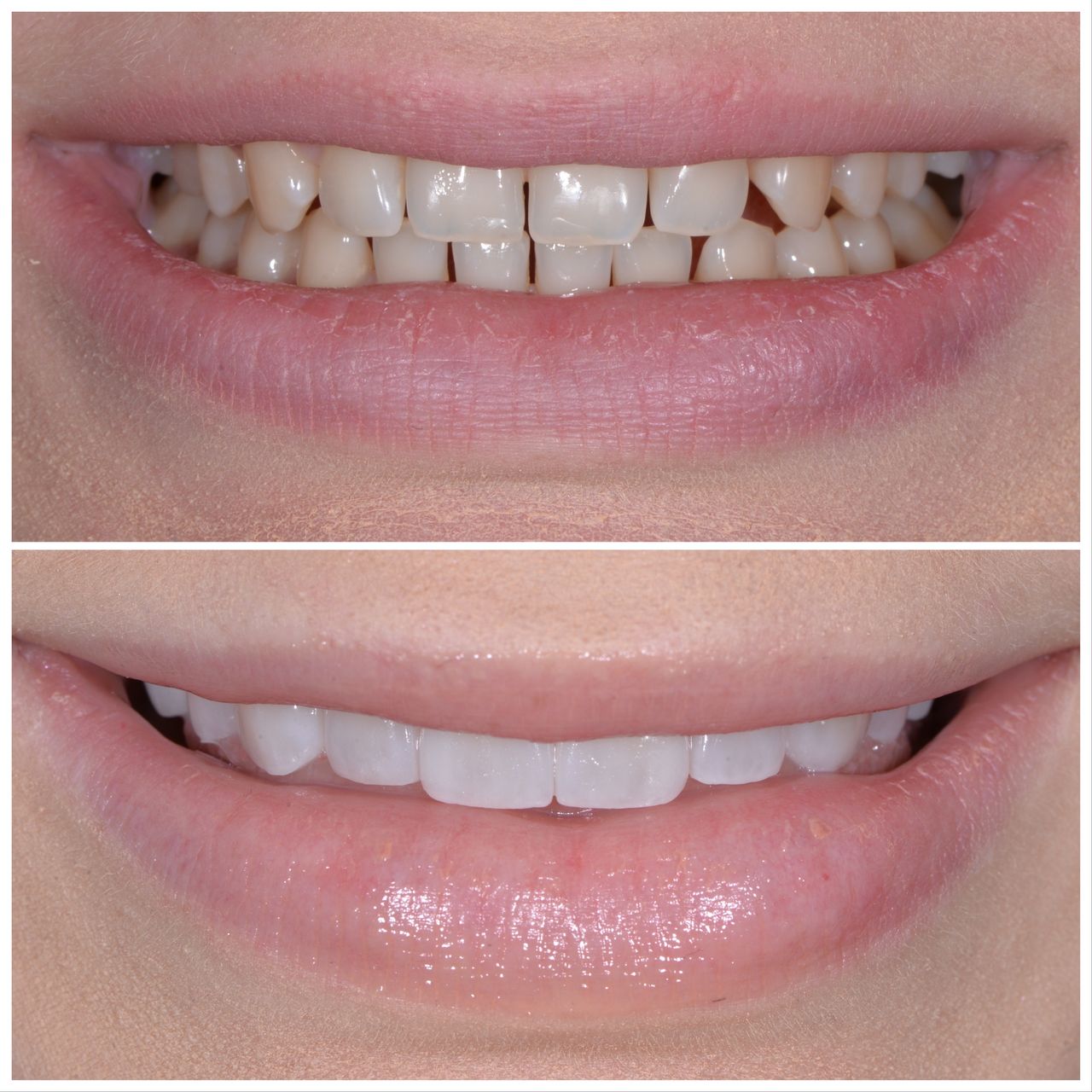 Martin Bartoszcze-30