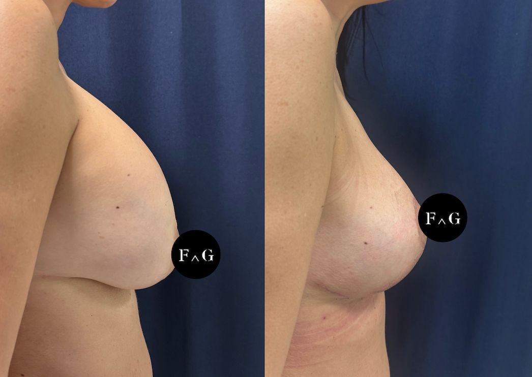 Federico Giorgini-34