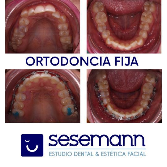 Paula Cano Carrillo-90