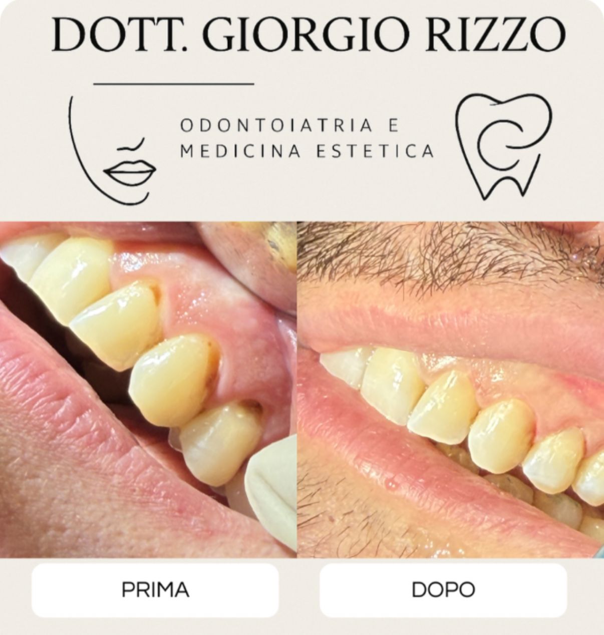 Giorgio Rizzo-30
