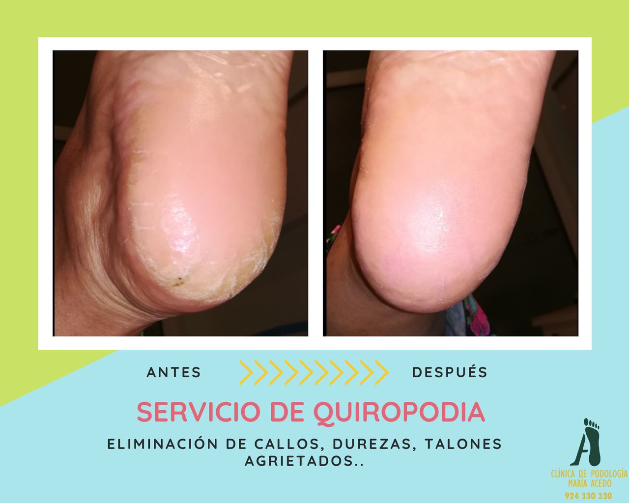 Maria Acedo Cañamero-8