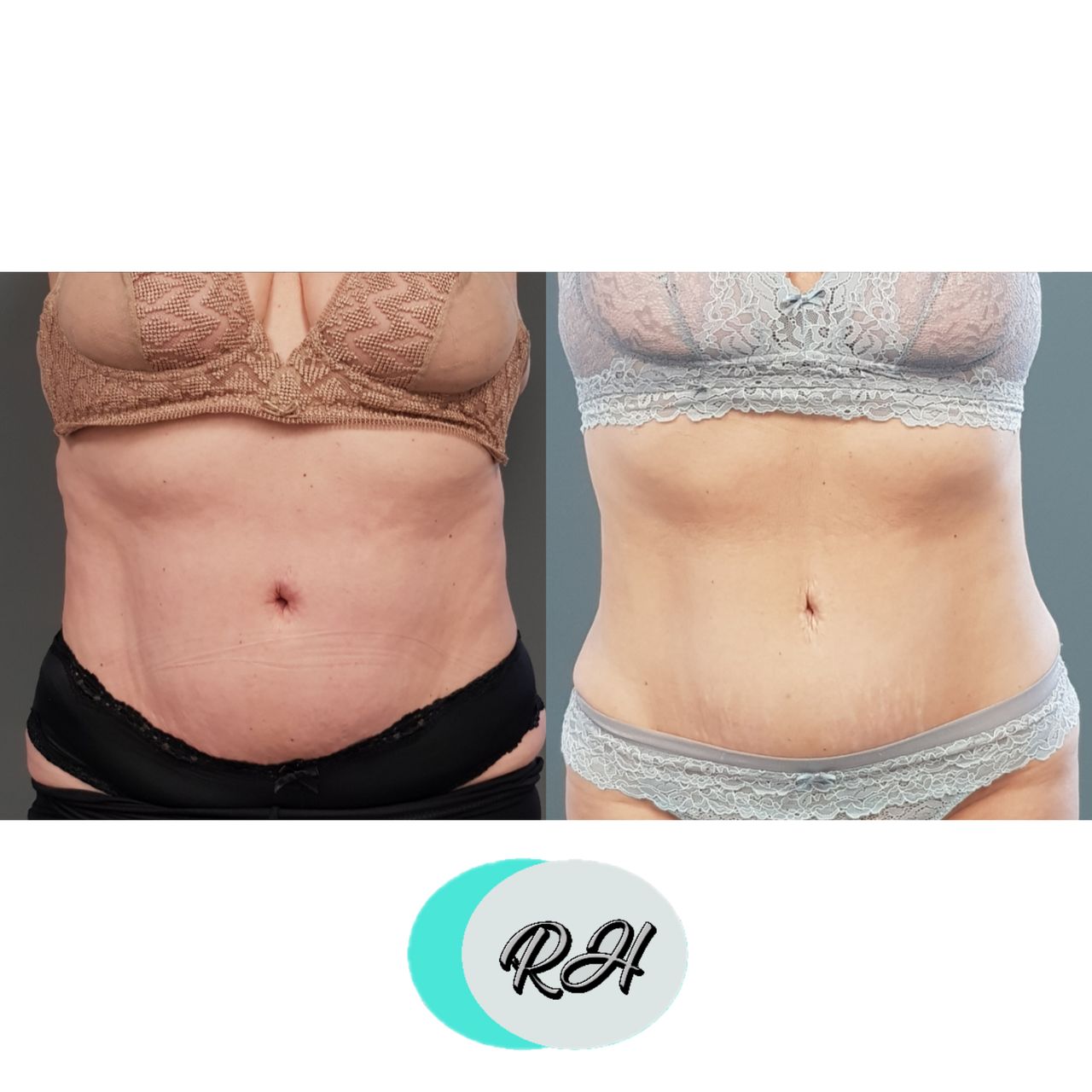 Rosalba Herrero Zerpa-189