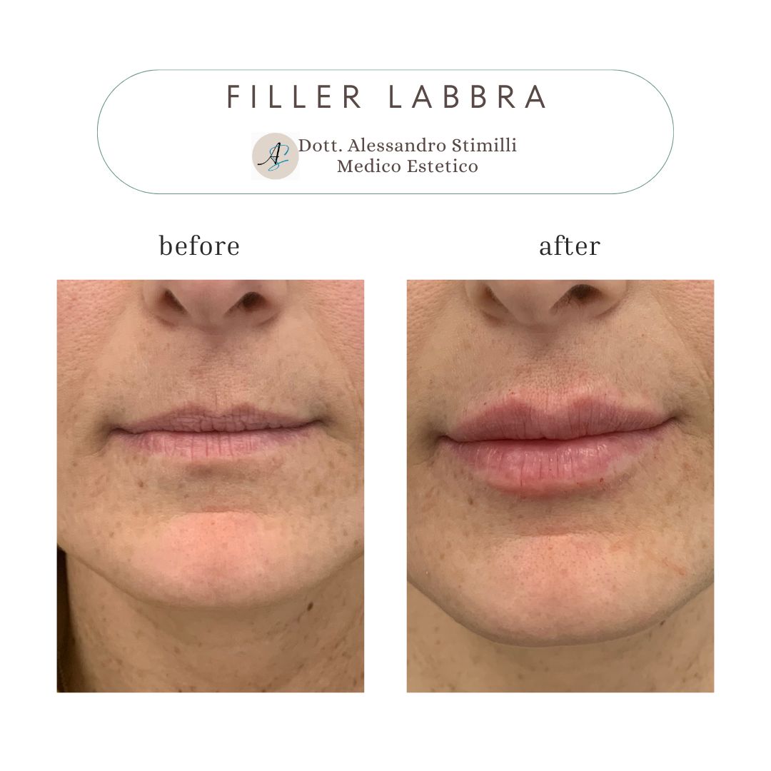 Alessandro Stimilli-5