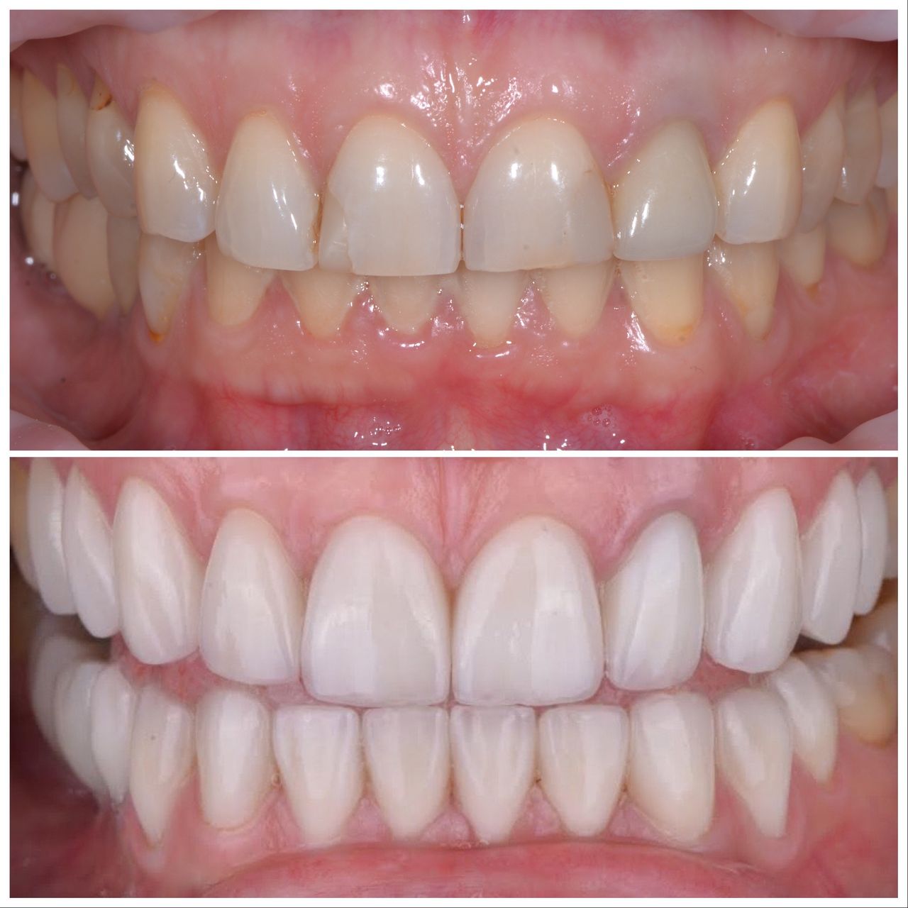 Martin Bartoszcze-36