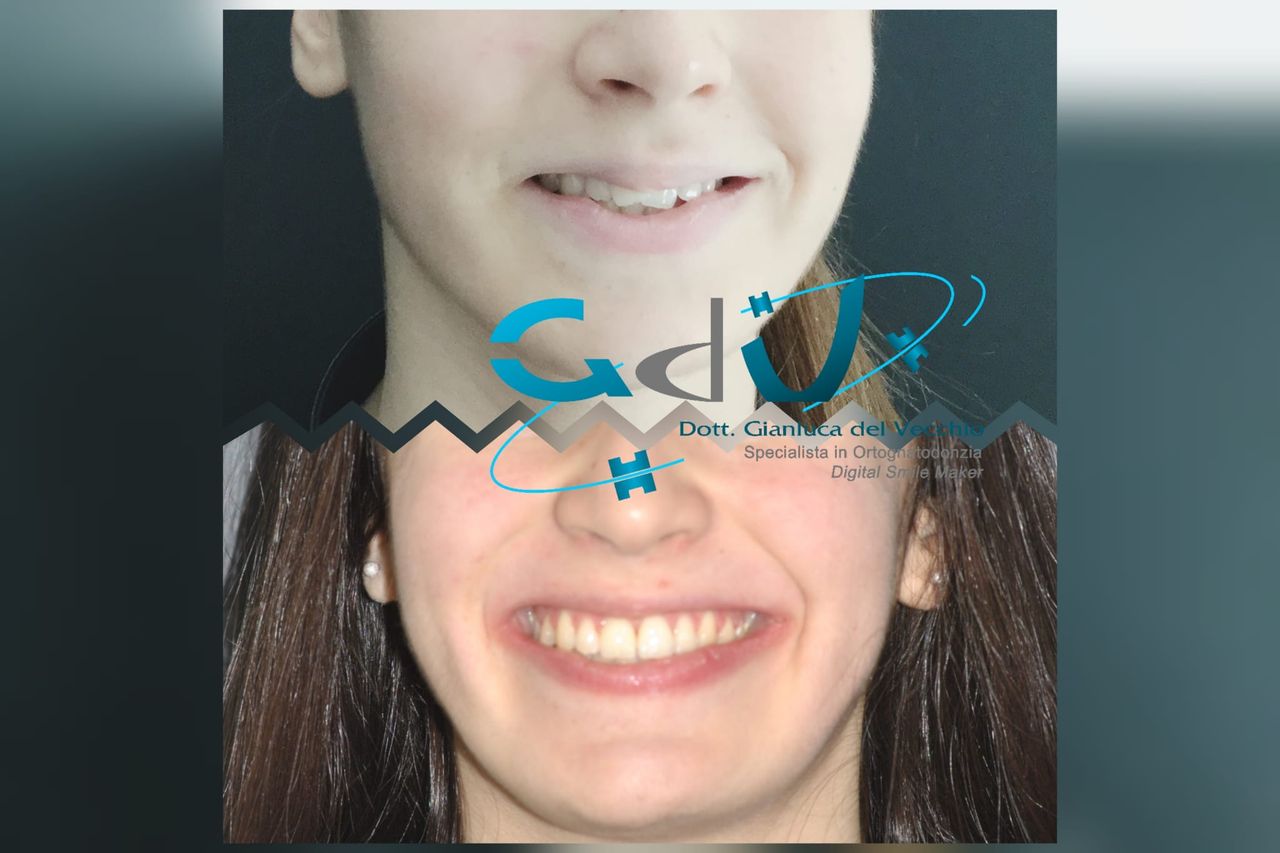 Gianluca Del Vecchio-187