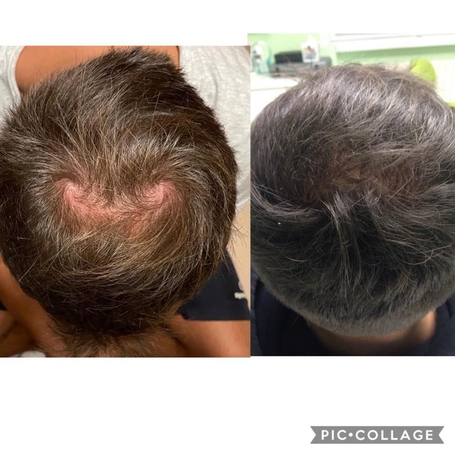 Giovanni Benfenati-7