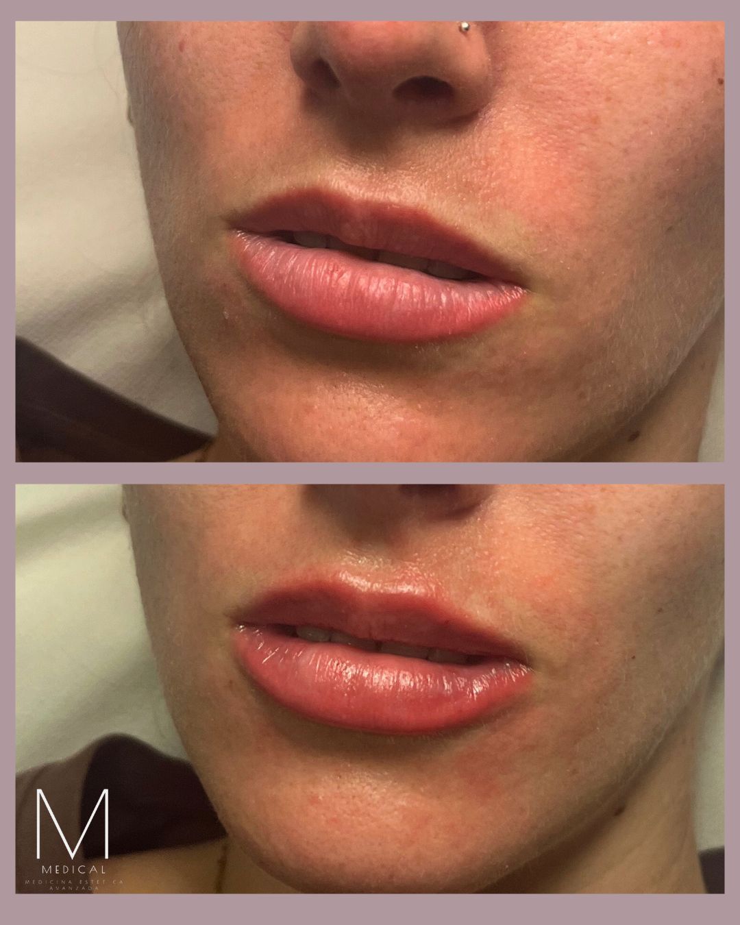 Marta Reyes Álvarez-12