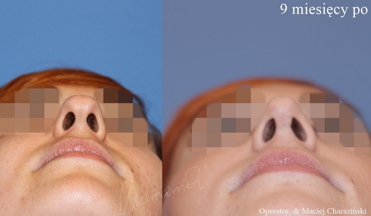 Maciej Charaziński-79