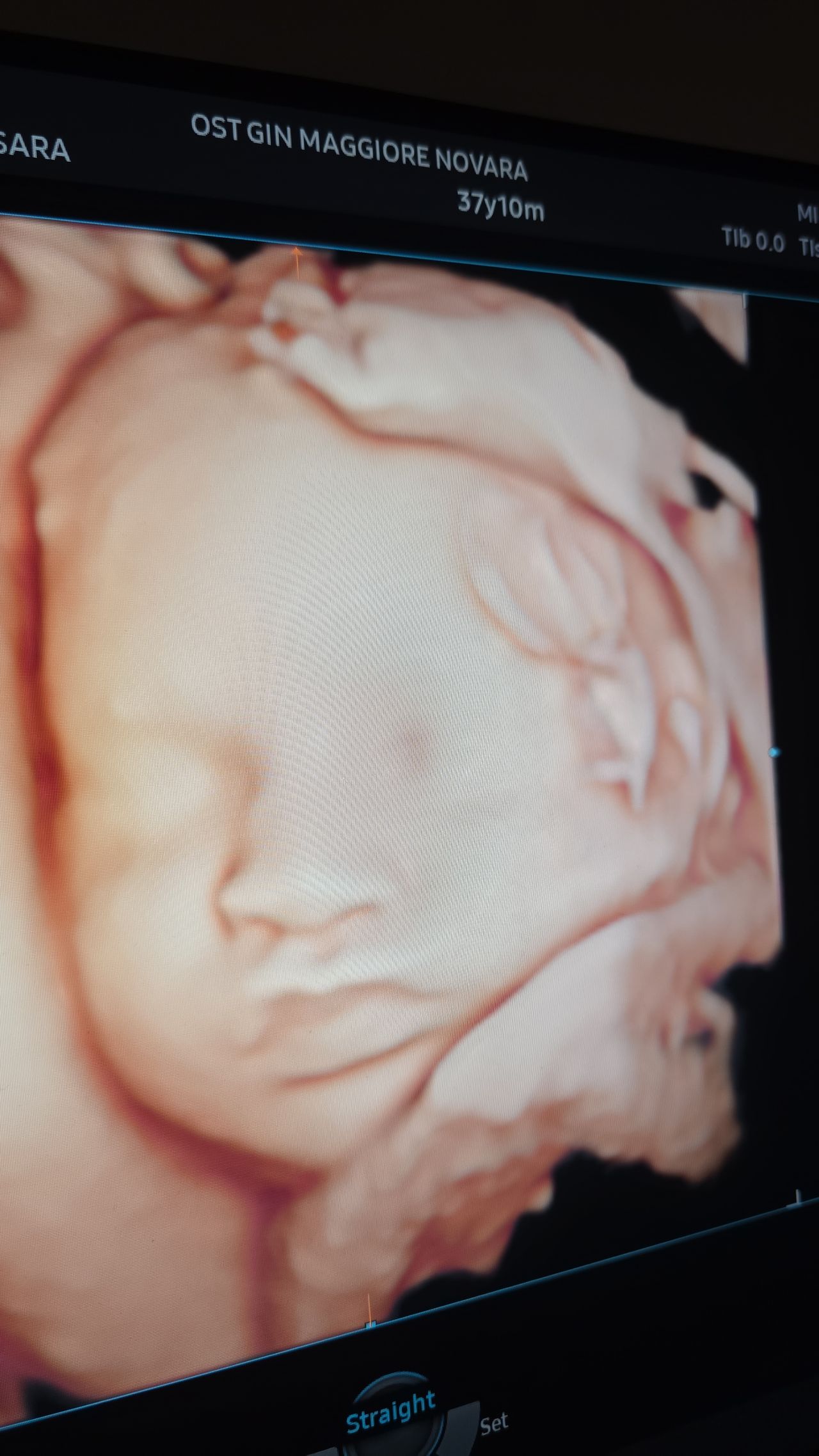 Alessandro Libretti-1