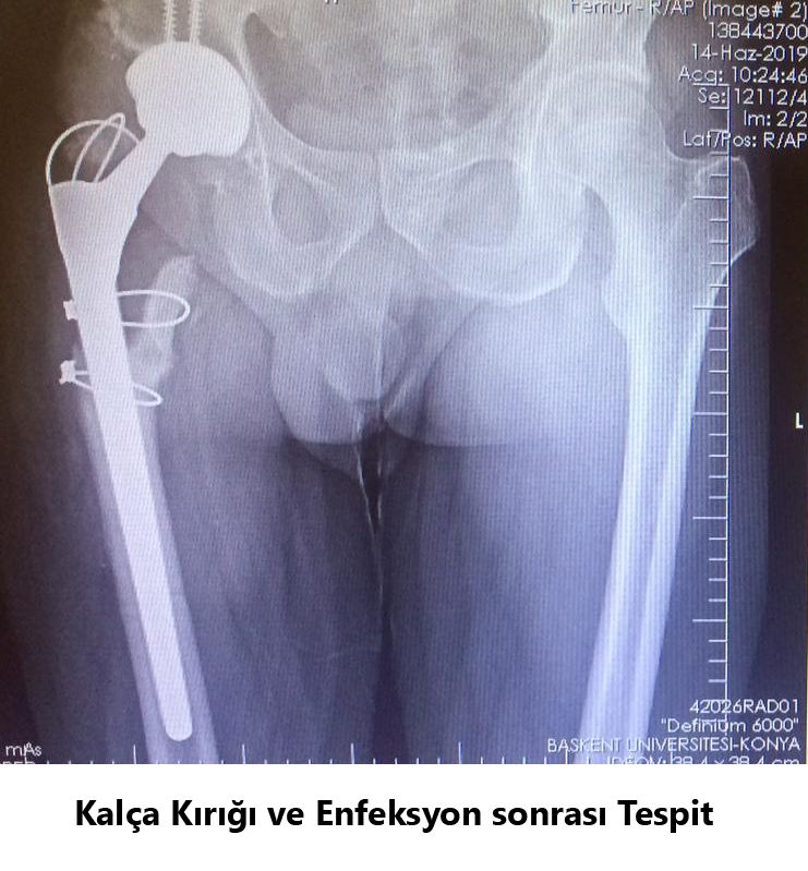 Javid M. Azarabadı-5