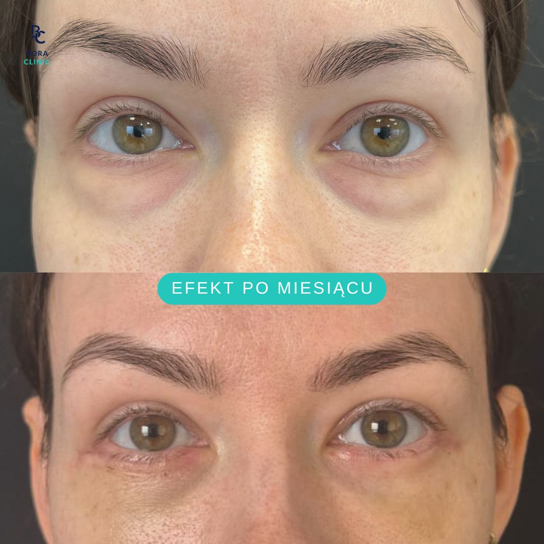 Anastasiia Grechyshkina-0