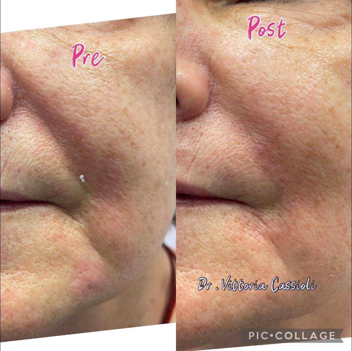 Vittoria Cassioli-72