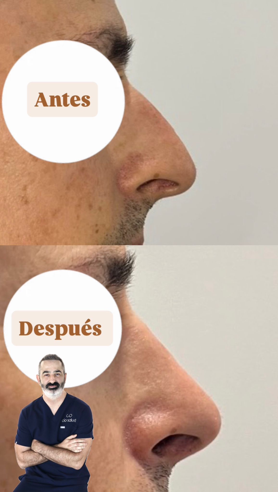 Nicolás Meana Cadrecha-4