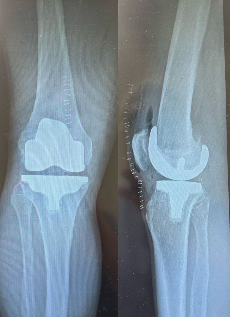 Alessandro Del Monaco-8