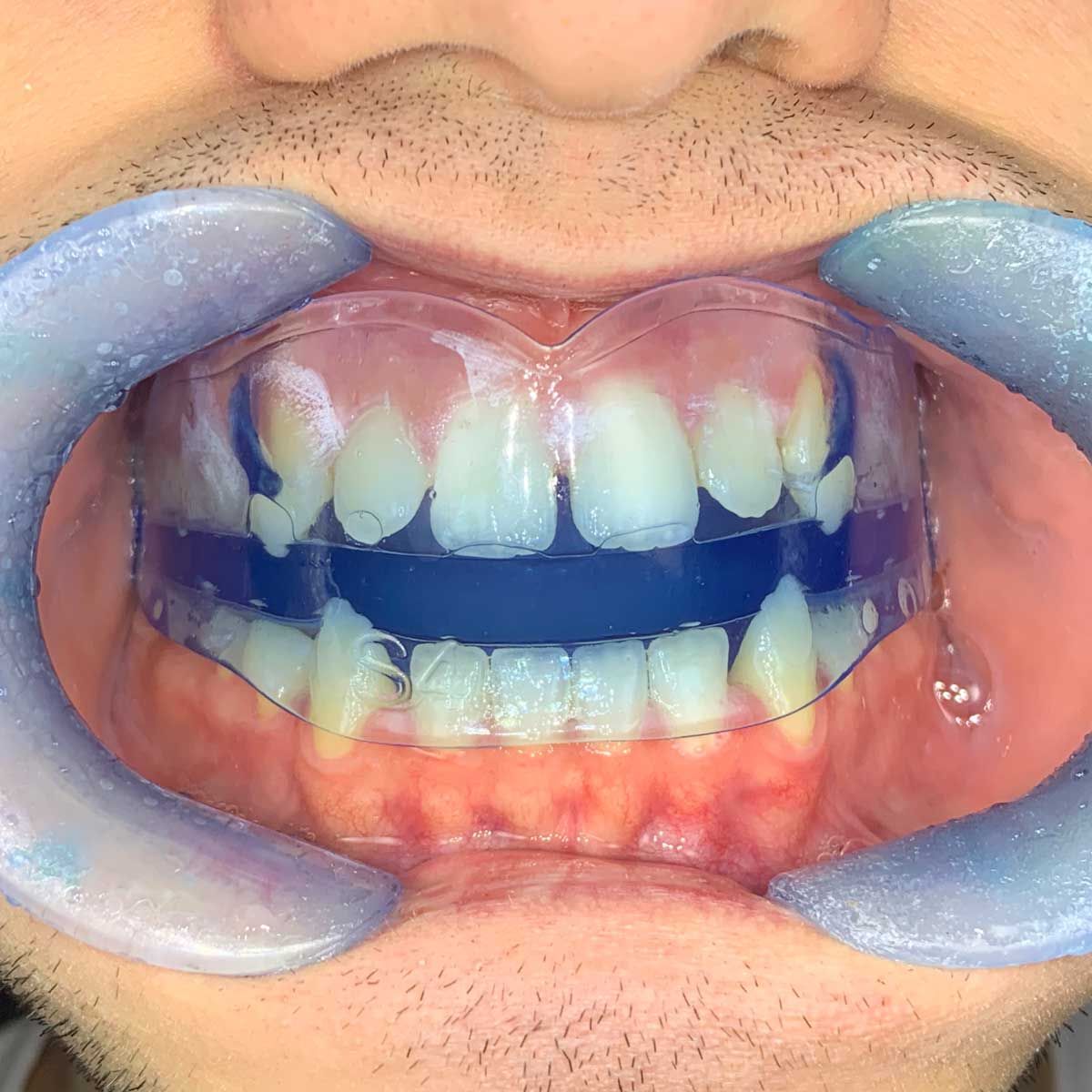 Gianluigi Bittante-9