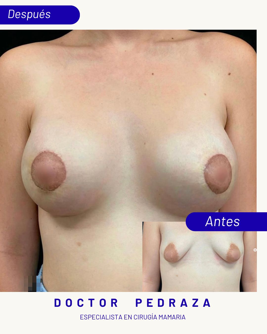 José María Pedraza Abad-1