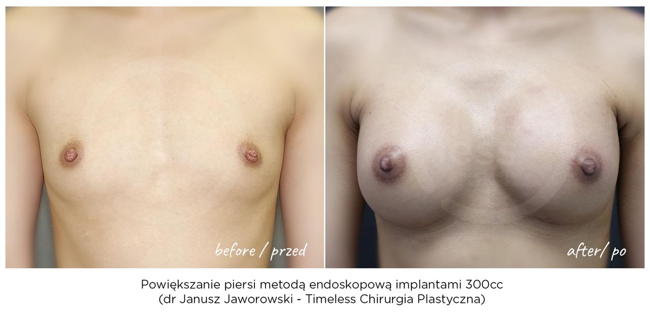 Janusz Jaworowski-156