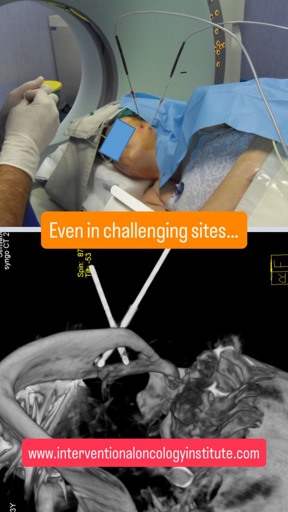 Salvatore Marsico-10