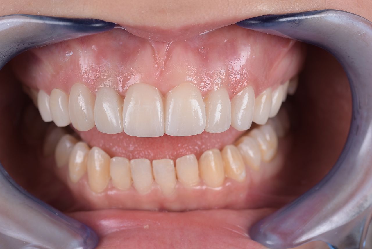 Riccardo Giardina-29