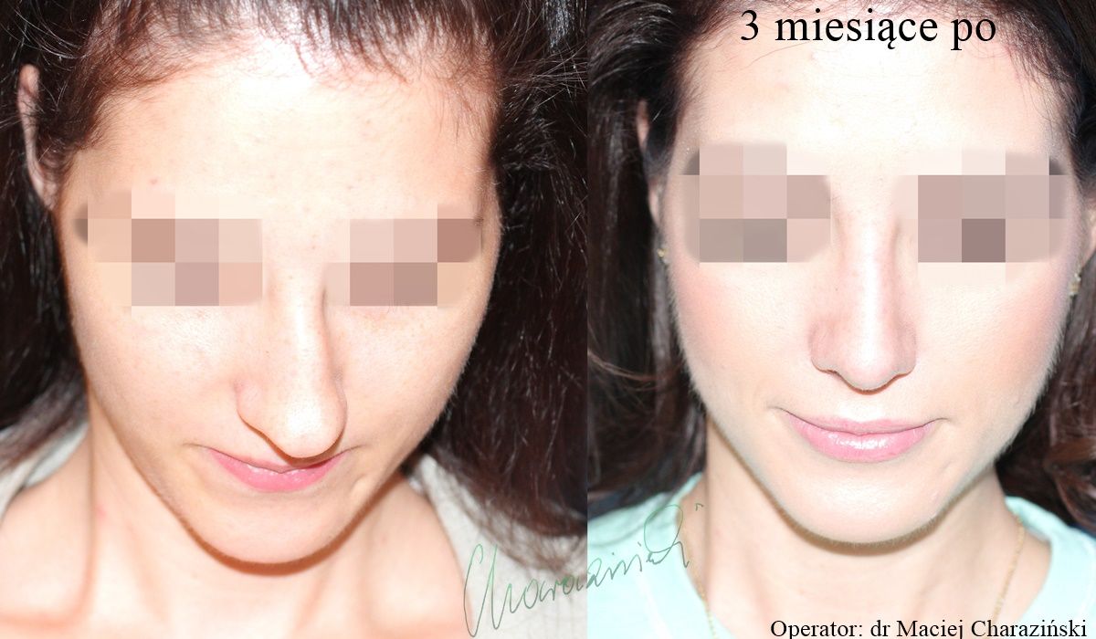 Maciej Charaziński-60