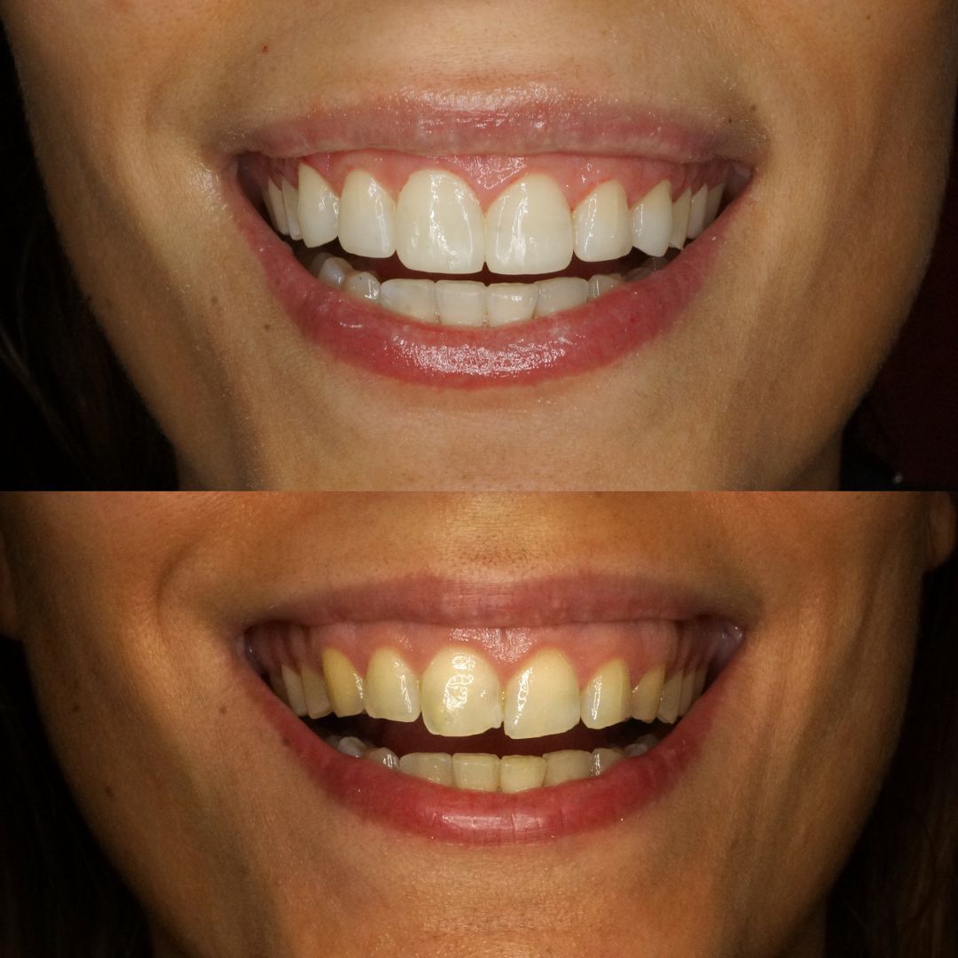 Raimonda Bogdanoviciute-22