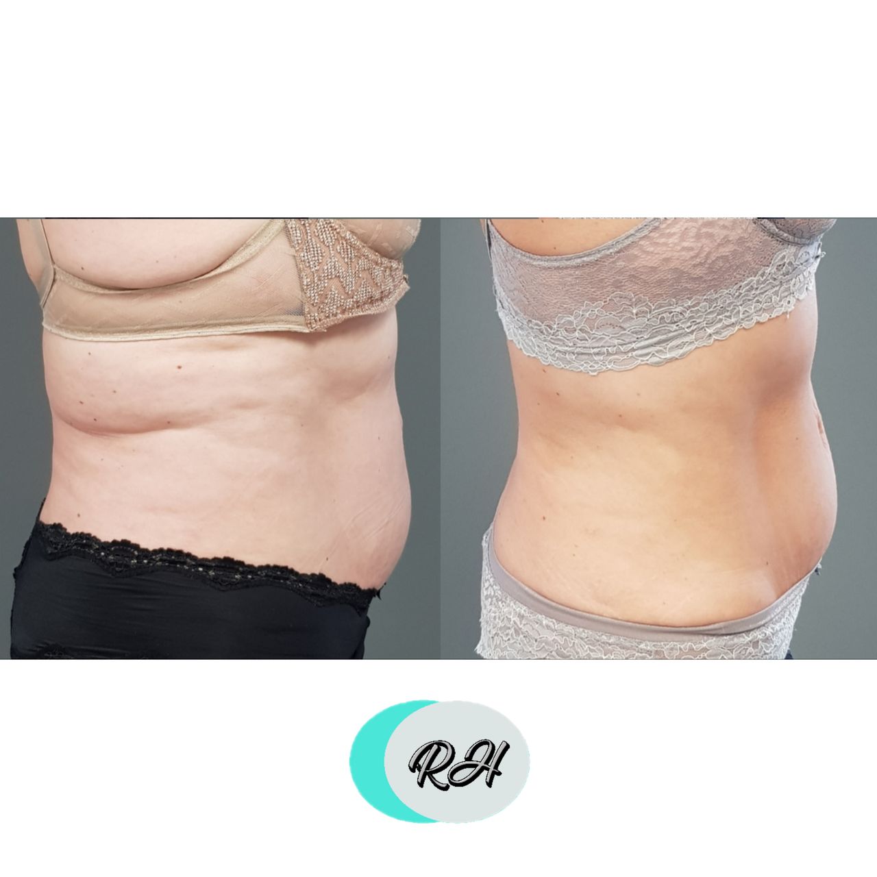 Rosalba Herrero Zerpa-188