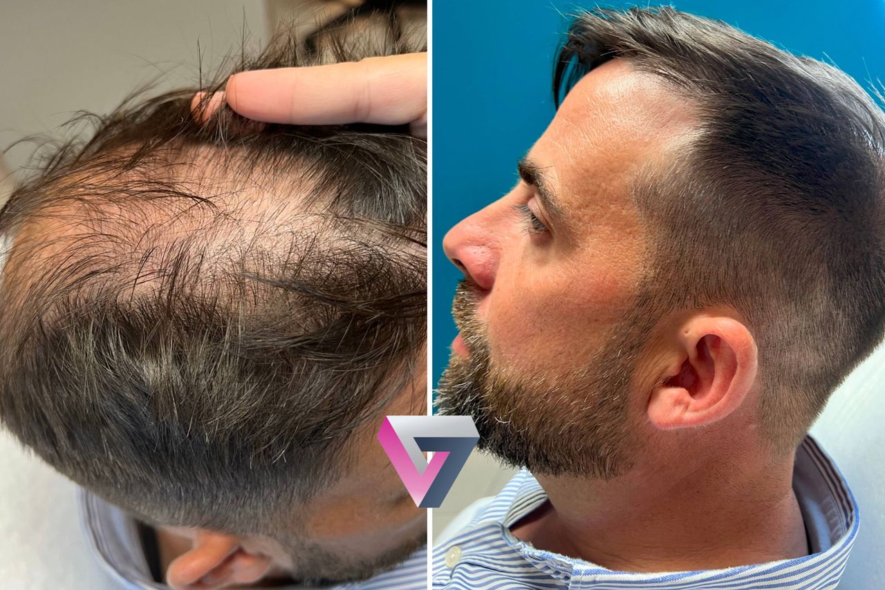 Victoria Trasmonte-76