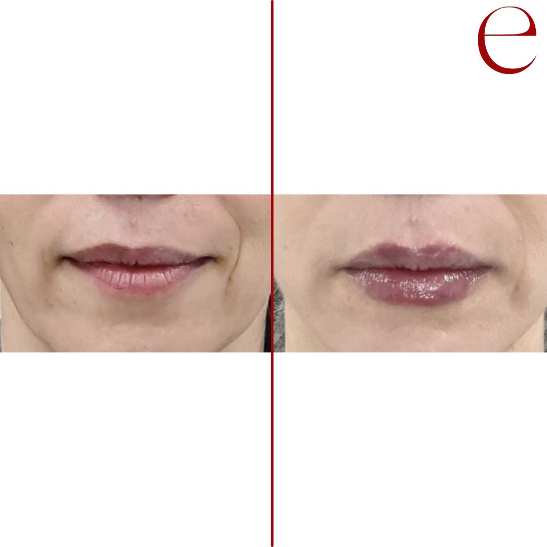 Raquel Moreno Pentinel-73