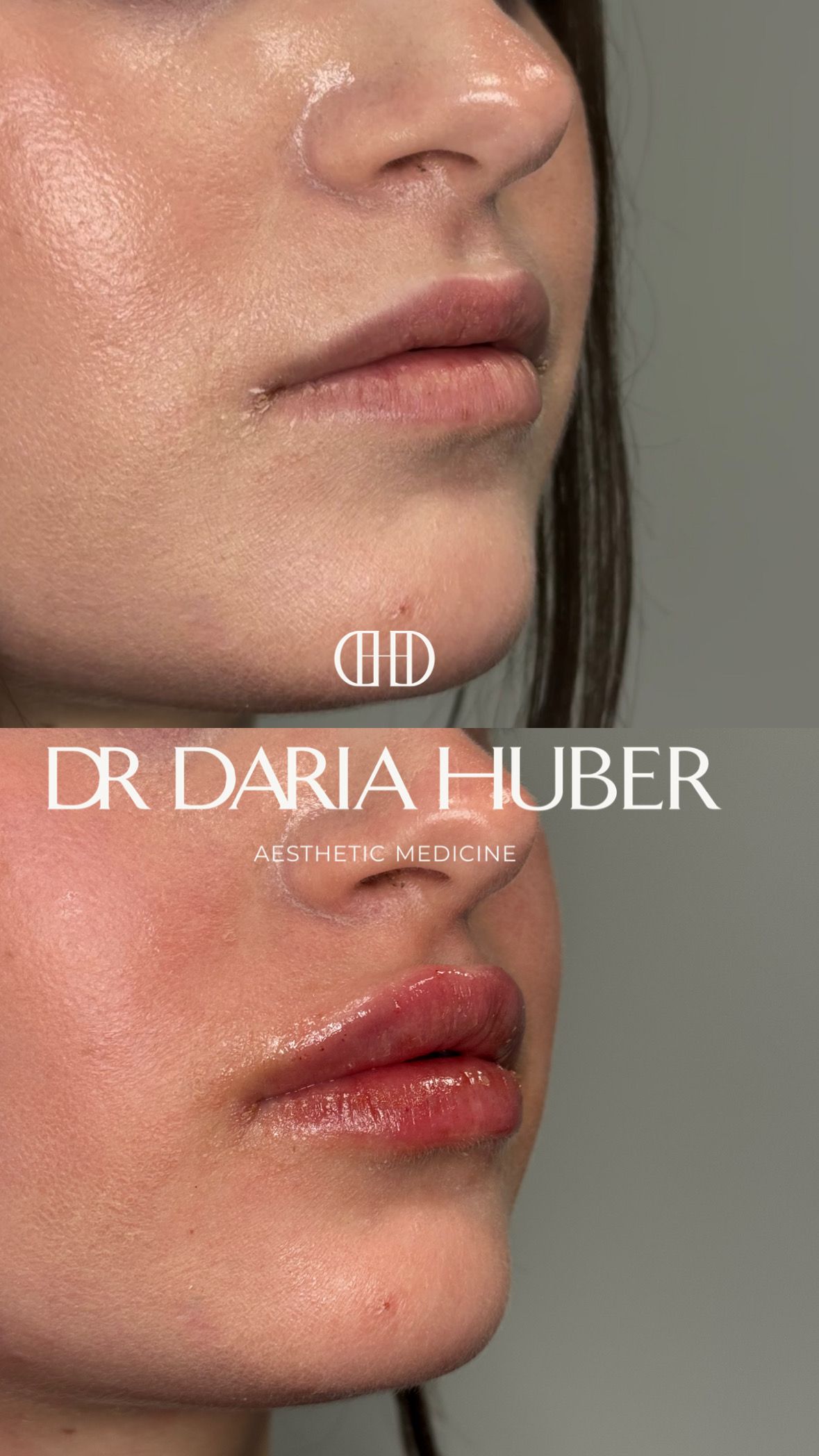 Daria Huber-53