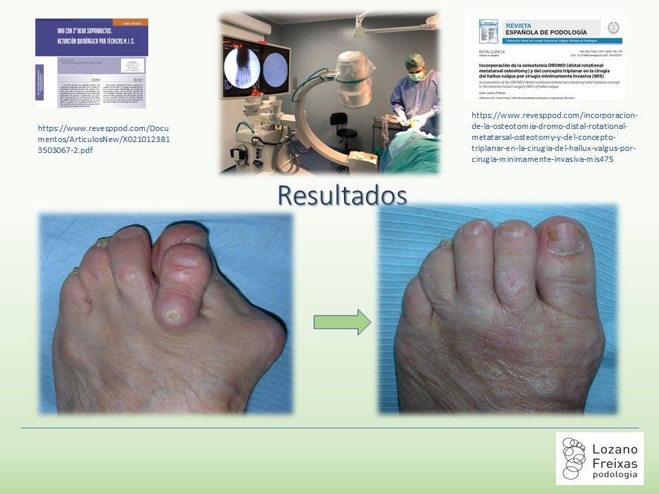 Joan Lozano Freixas-26